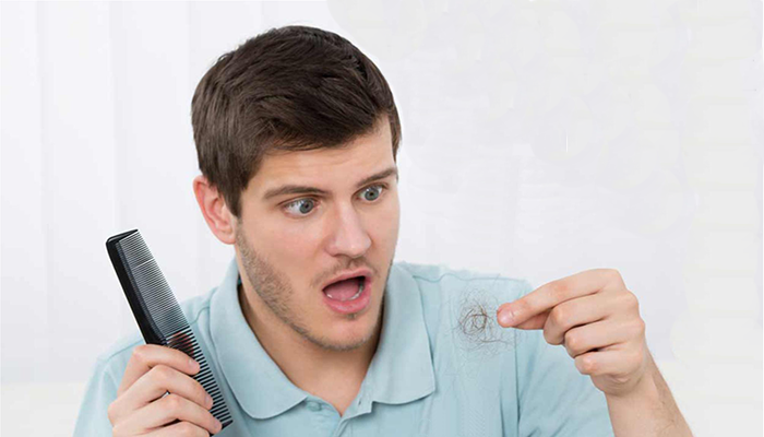 Stages of hair fall in men