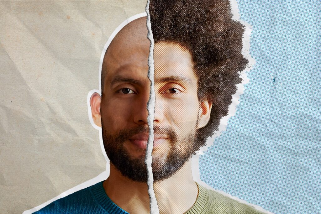 How to maintain the hair patch at home