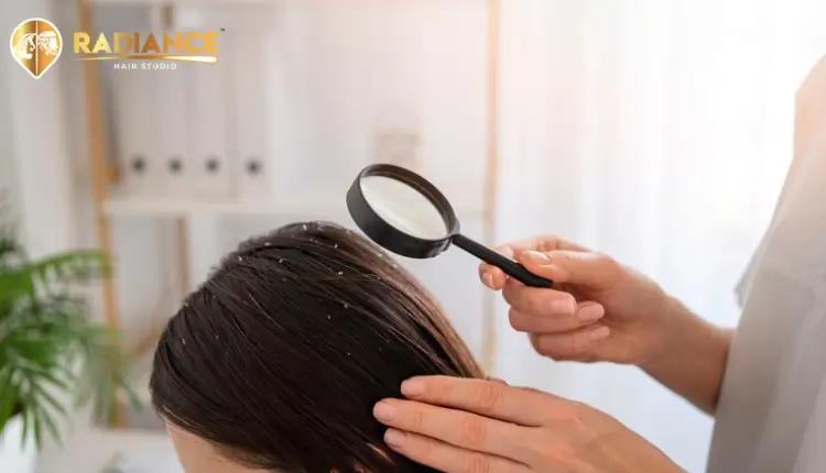 Woman suffering from dandruff and dry scalp