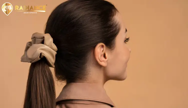 on-surgical hair patch treatment in Delhi salon