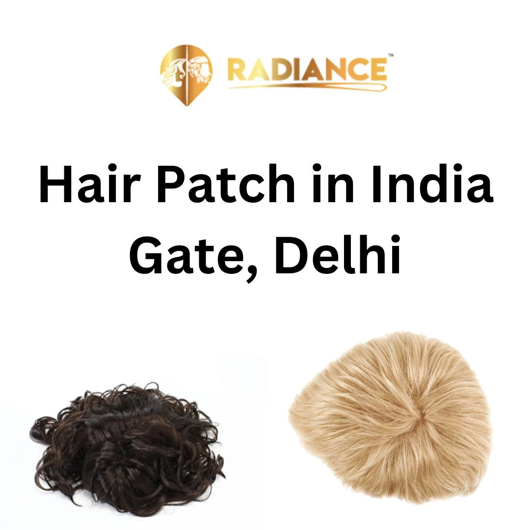 Hair Patch in India Gate, Delhi