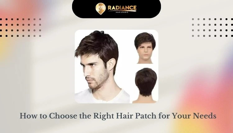 How to choose the right hair patch for your needs