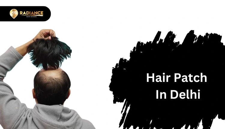 Natural hair patch solution for men in Delhi