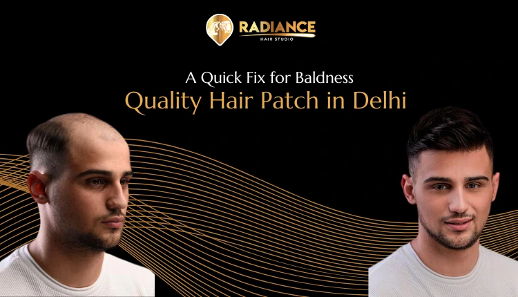 Quality Hair Patch in Delhi