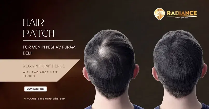 Hair Patch for Men in Keshav Puram Delhi