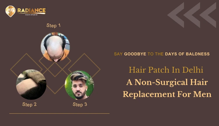 A non-surgical hair replacement for men