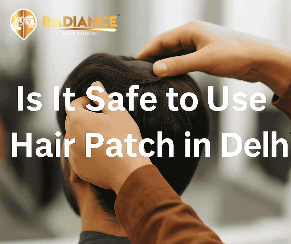 Is It Safe to Use a Hair Patch in Delhi?