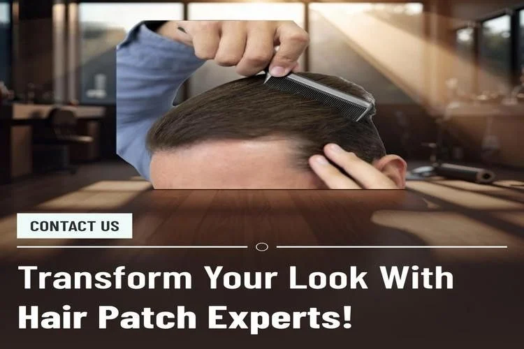hair patch in shalimar bagh delhi