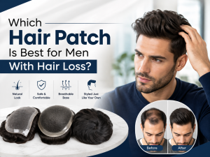 best hair patch for men
