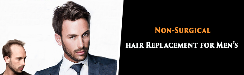 Non Surgical Hair Replacement In Delhi - Radiance Hair Studio